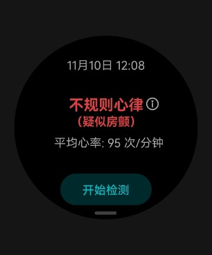 展示了 HUAWEI WATCH Ultimate 2 支持  ECG 心电分析