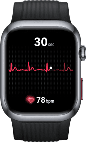 HUAWEI WATCH D2's interface,showing the ECG analysis feature