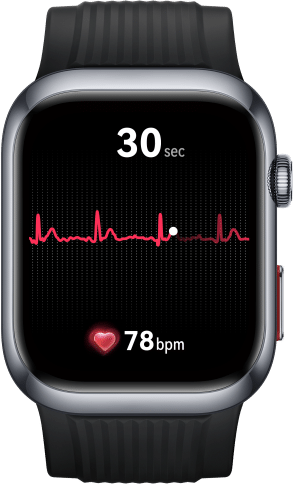 HUAWEI WATCH D2's interface,showing the ECG analysis feature