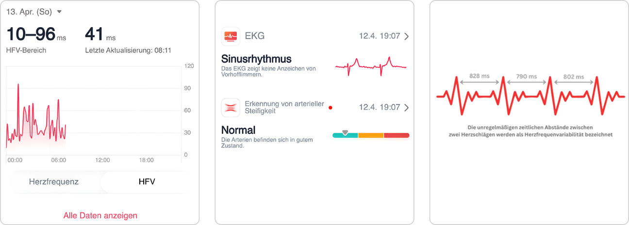 HUAWEI WATCH 5: A Partner in Health Management